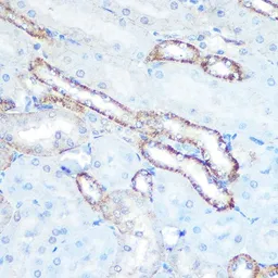 Anti-N-WASP antibody [GT1328] used in IHC (Paraffin sections) (IHC-P). GTX03240