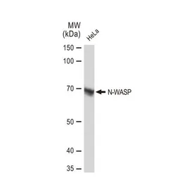 Anti-N-WASP antibody [GT1328] used in Western Blot (WB). GTX03240