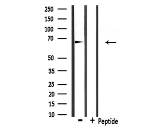 Anti-Involucrin antibody used in Western Blot (WB). GTX03271