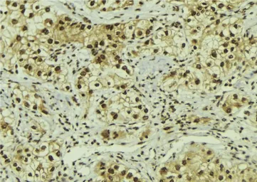 Anti-FOXO1 (Acetyl Lys294) antibody used in IHC (Paraffin sections) (IHC-P). GTX03372