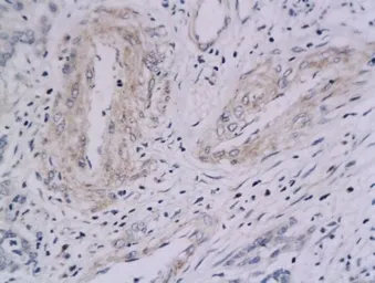 Anti-Integrin alpha V + beta 5 antibody used in IHC (Paraffin sections) (IHC-P). GTX03382