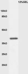 Anti-KLF2 antibody used in Western Blot (WB). GTX03383