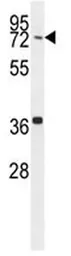 Anti-CCDC38 antibody used in Western Blot (WB). GTX03392