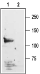 Anti-NMDAR1 antibody used in Western Blot (WB). GTX03399