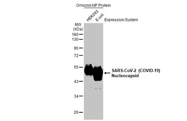 SARS-CoV-2 (COVID-19) Nucleocapsid protein, B.1.1.529 / Omicron variant, His tag. GTX03400-pro