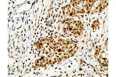 Anti-Ki67 (phospho Thr1335) antibody used in IHC (Paraffin sections) (IHC-P). GTX03435
