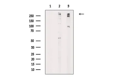 Anti-Ki67 (phospho Thr1335) antibody used in Western Blot (WB). GTX03435