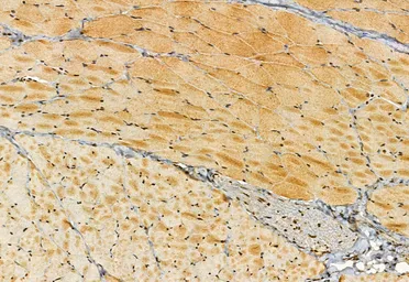 Anti-SMCR7 antibody used in IHC (Paraffin sections) (IHC-P). GTX03455