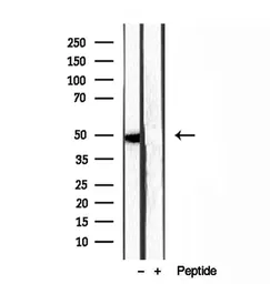 Anti-SMCR7 antibody used in Western Blot (WB). GTX03455