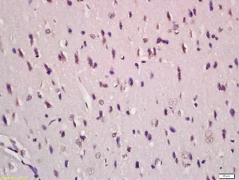 Anti-TGF beta antibody used in IHC (Paraffin sections) (IHC-P). GTX03464