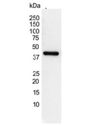 Anti-Actin Gamma 1 antibody [2A3] used in Western Blot (WB). GTX03493