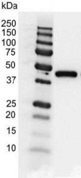 Anti-Actin Gamma 1 antibody [2A3] used in Western Blot (WB). GTX03493