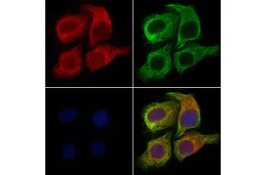 Anti-Microcephalin antibody used in Immunocytochemistry/ Immunofluorescence (ICC/IF). GTX03494