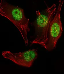 Anti-MyoD1 antibody used in Immunocytochemistry/ Immunofluorescence (ICC/IF). GTX03495
