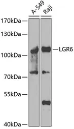 Anti-LGR6 antibody used in Western Blot (WB). GTX03496
