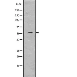 Anti-Suppressor of Fused antibody used in Western Blot (WB). GTX03498