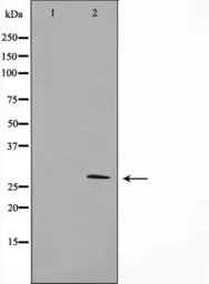Anti-14-3-3 zeta antibody used in Western Blot (WB). GTX03588
