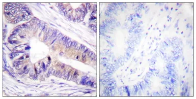 Anti-14-3-3 zeta antibody used in IHC (Paraffin sections) (IHC-P). GTX03589