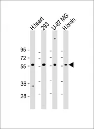 Anti-ENTPD2 antibody used in Western Blot (WB). GTX03639