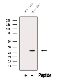 Anti-Neutrophil elastase antibody used in Western Blot (WB). GTX03640