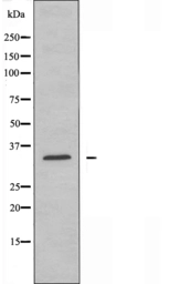 Anti-NEGR1 antibody used in Western Blot (WB). GTX03680