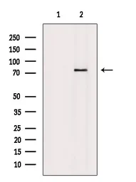 Anti-RIP (phospho Tyr384) antibody used in Western Blot (WB). GTX03682