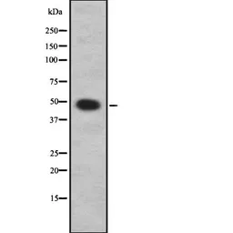 Anti-ARRDC1 antibody used in Western Blot (WB). GTX03690