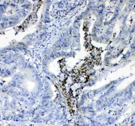 Anti-Prothrombin antibody used in IHC (Paraffin sections) (IHC-P). GTX03694