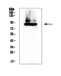 Anti-Prothrombin antibody used in Western Blot (WB). GTX03694