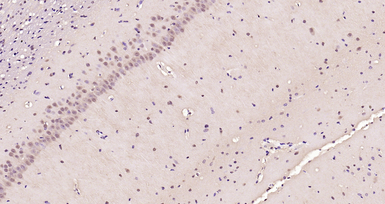 Anti-AMPK alpha 1 (phospho Thr183) + AMPK alpha 2 (phospho Thr172) antibody used in IHC (Paraffin sections) (IHC-P). GTX03702