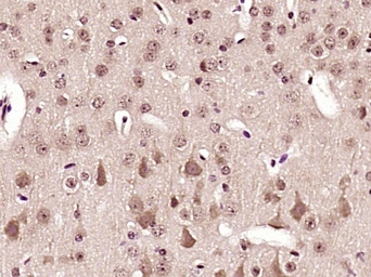 Anti-AMPK alpha 1 (phospho Thr183) + AMPK alpha 2 (phospho Thr172) antibody used in IHC (Paraffin sections) (IHC-P). GTX03702