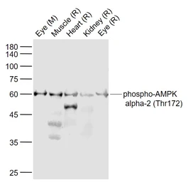 Anti-AMPK alpha 1 (phospho Thr183) + AMPK alpha 2 (phospho Thr172) antibody used in Western Blot (WB). GTX03702