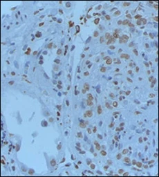 Anti-Gremlin 1 antibody used in IHC (Paraffin sections) (IHC-P). GTX03707