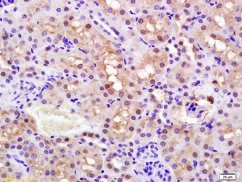Anti-PPAR alpha (phospho Ser12) antibody used in IHC (Paraffin sections) (IHC-P). GTX03713