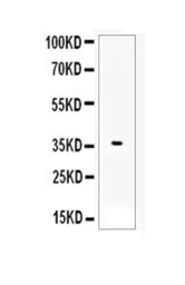 Anti-AHR antibody used in Western Blot (WB). GTX03719
