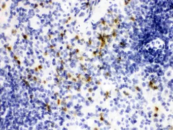 Anti-Lipocalin-2 antibody used in IHC (Paraffin sections) (IHC-P). GTX03729