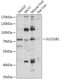Anti-OATP2 antibody used in Western Blot (WB). GTX03730