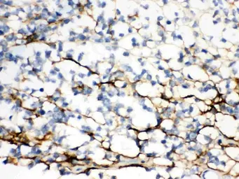 Anti-Versican antibody used in IHC (Paraffin sections) (IHC-P). GTX03733