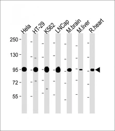 Anti-SCAP antibody used in Western Blot (WB). GTX03796
