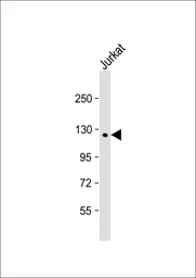 Anti-PTPD1 antibody used in Western Blot (WB). GTX03798