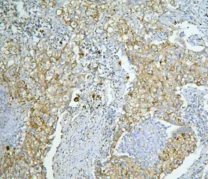 Anti-LONP1 antibody used in IHC (Paraffin sections) (IHC-P). GTX03806