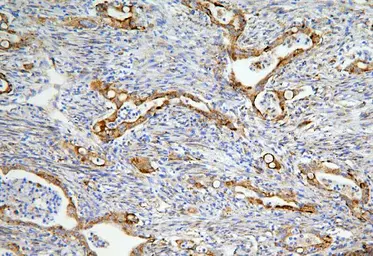 Anti-LONP1 antibody used in IHC (Paraffin sections) (IHC-P). GTX03806