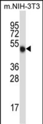 Anti-MLKL antibody used in Western Blot (WB). GTX03807