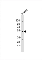 Anti-MLKL antibody used in Western Blot (WB). GTX03807