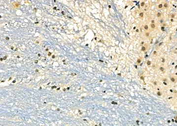 Anti-DMP1 antibody used in IHC (Paraffin sections) (IHC-P). GTX04077