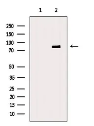 Anti-DMP1 antibody used in Western Blot (WB). GTX04077