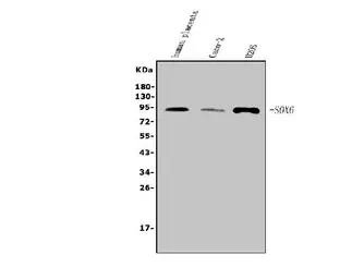 Anti-SOX6 antibody used in Western Blot (WB). GTX04085