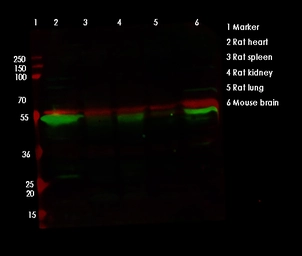 Anti-TFEB antibody used in Western Blot (WB). GTX04086