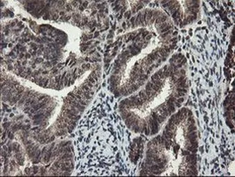 Anti-TDO2 antibody [OTI2A4] used in IHC (Paraffin sections) (IHC-P). GTX04090