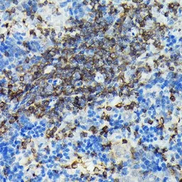 Anti-PI3 kinase p110 gamma antibody used in IHC (Paraffin sections) (IHC-P). GTX04094